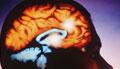 brain