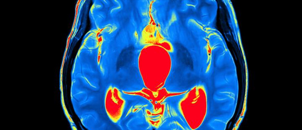 Can diet and exercise change the brain? 