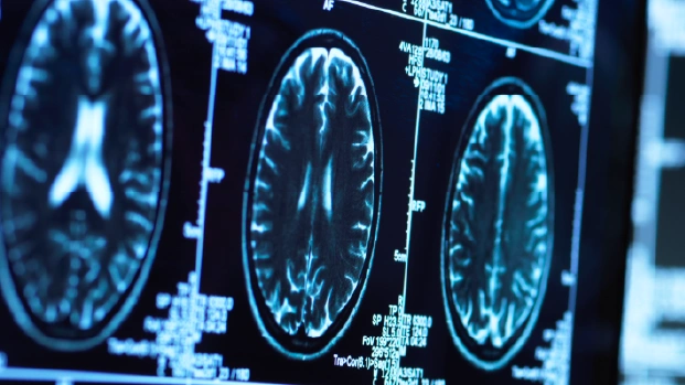 Summary: Amyloid and Tau PET Updated AUC