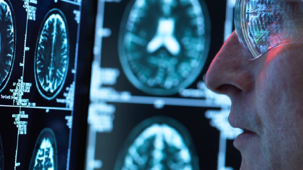 Appropriate Use Criteria for Amyloid and Tau PET Imaging