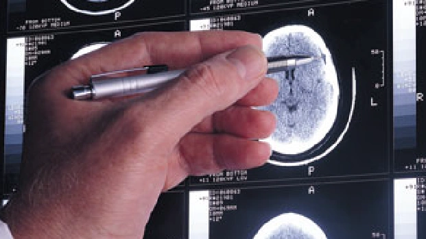 Lecanemab Resources for Health Care Professionals