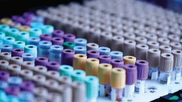 Evidence-Based Standardized Sample Handling Protocol for Blood-Based AD Biomarker Measurement