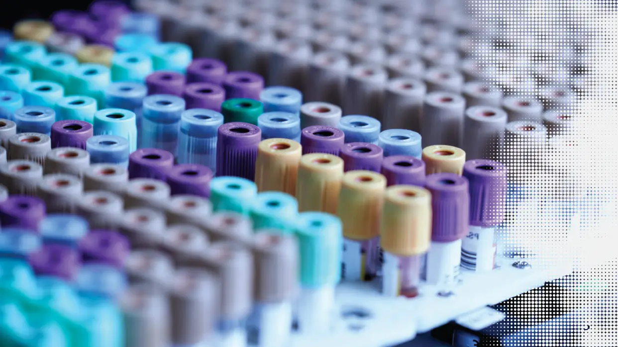Evidence-Based Standardized Sample Handling Protocol for Blood-Based AD Biomarker Measurement