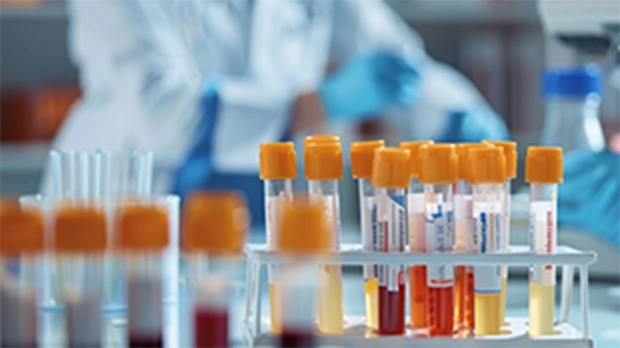 Biomarkers Collection