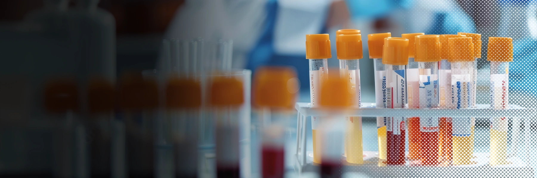 Biomarkers Collection