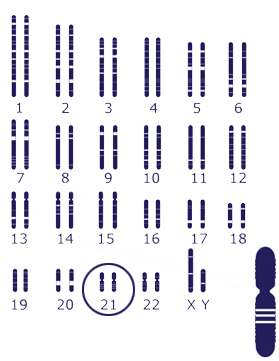 Image of human chromosomes