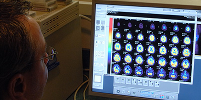 Computer screen showing brain imaging